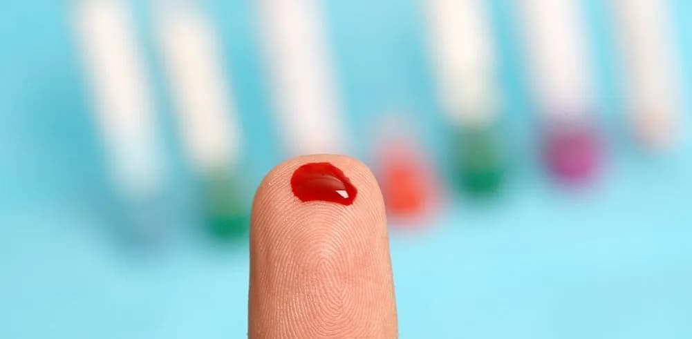 Blutuntersuchung bei Krebs: Wie Tests Leben retten können und was Sie wissen sollten