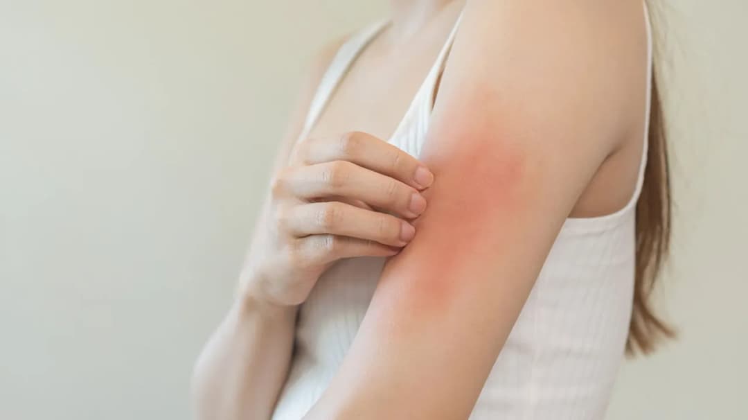 Blutuntersuchung nach Zeckenbiss: Wann ist sie wirklich nötig?