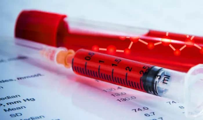 Hämophilie Diagnostik: Wichtige Schritte und Symptome, die Sie kennen sollten