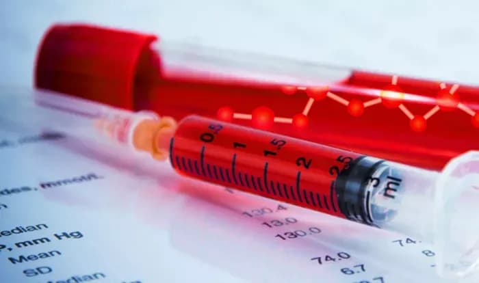 Hämophilie Diagnostik: Wichtige Schritte und Symptome, die Sie kennen sollten