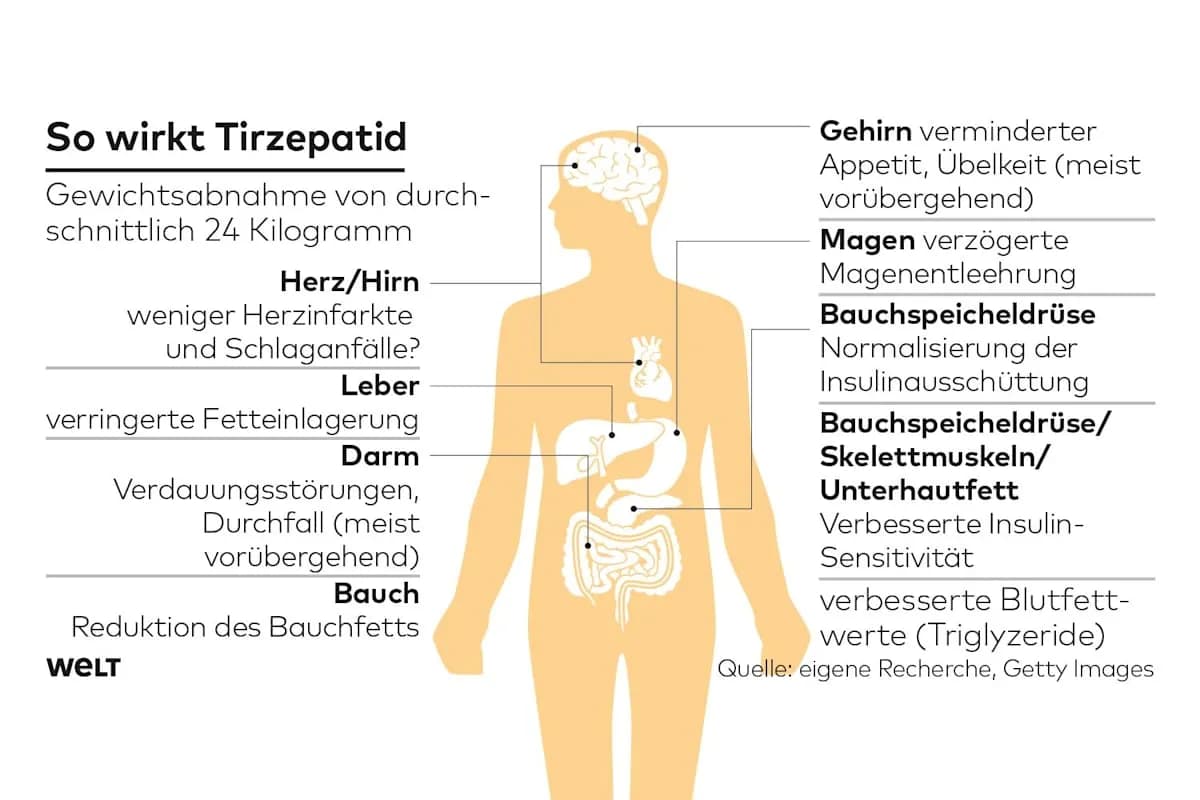 Neues Medikament für Diabetiker zum Abnehmen: Tirzepatid erklärt