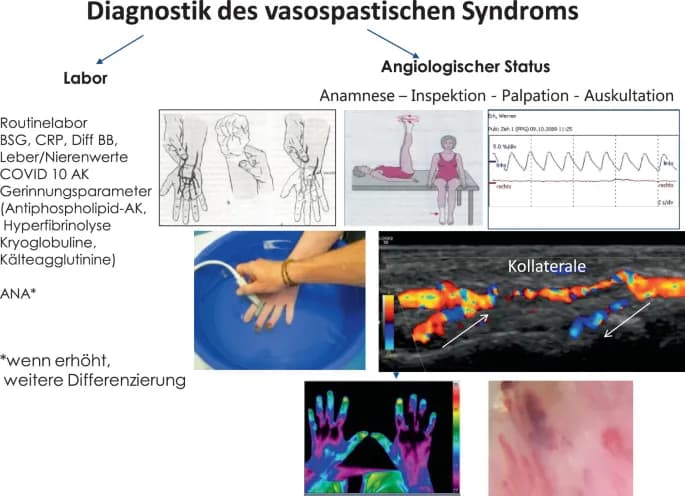 Die entscheidenden Schritte zur Diagnose des Flush-Syndroms verstehen