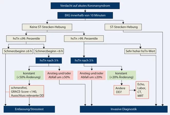 Myokardinfarkt Diagnostik: Wichtige Tests und Symptome erkennen