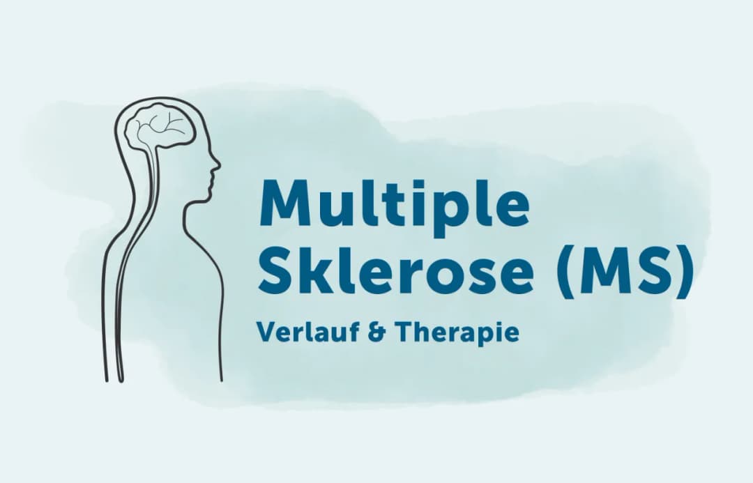 Multiple Sklerose Klinik: Wichtige Diagnostik und Therapieansätze