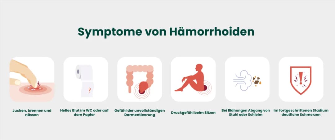 Hämorrhoiden Symptome: Erkennen Sie die Anzeichen und vermeiden Sie Schmerzen