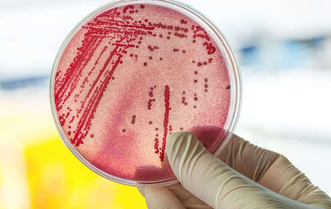 Symptome E. coli: Erkennen Sie die gefährlichen Anzeichen einer Infektion